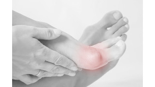 Poursuivre le sport avec un hallux valgus Sport Protech